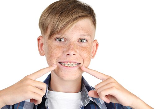 Young boy with dental braces on white background